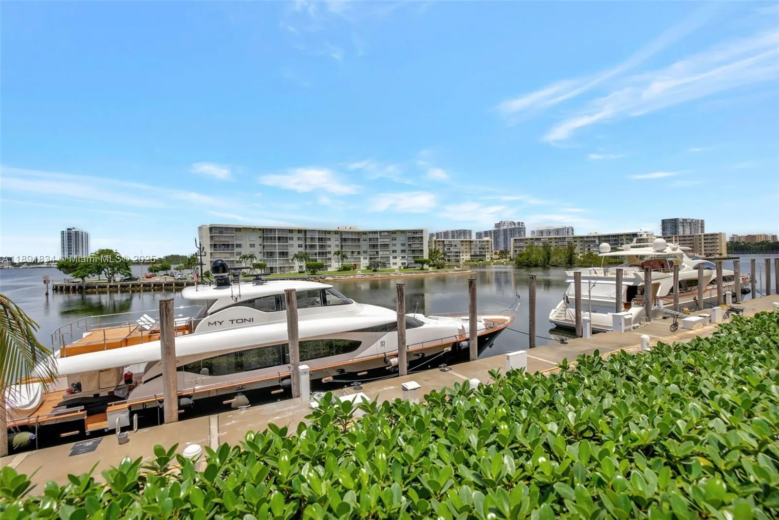 1000 Island Blvd, #1004